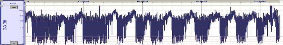 Example of automatic CFM trend in SleepRT